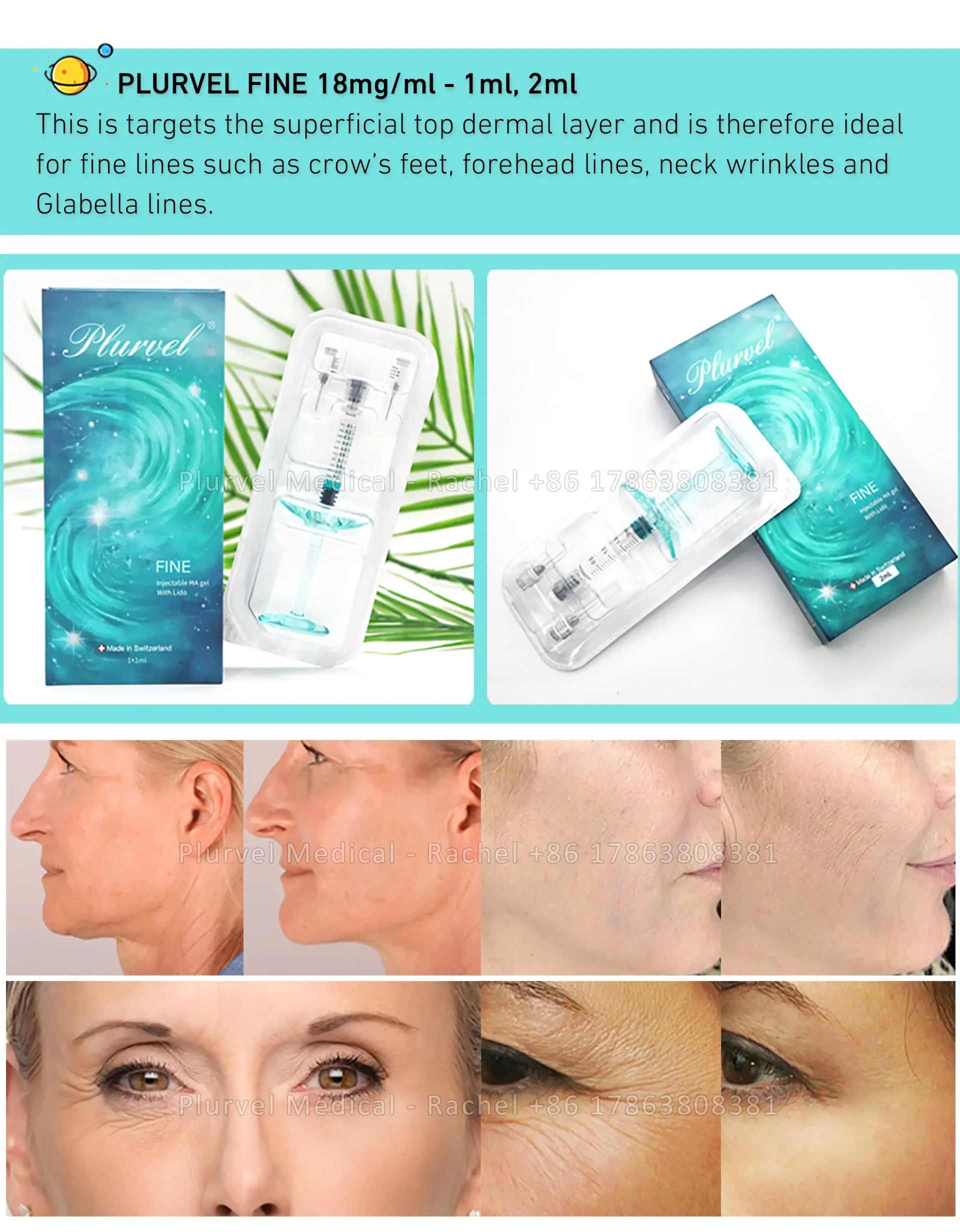 Deep Sodium Hyaluronate Facial Contouring 20ml — HA Filler / Deep product image 4